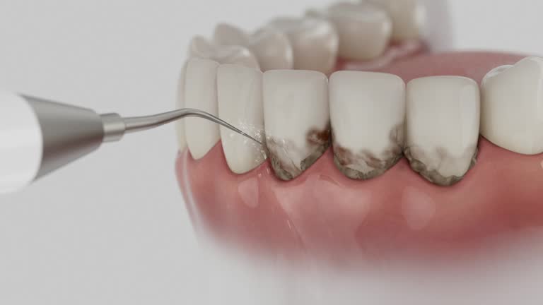 Reliable Root Canal Treatment contractor in Calcasieu Parish County, LA by Dentist Open Now